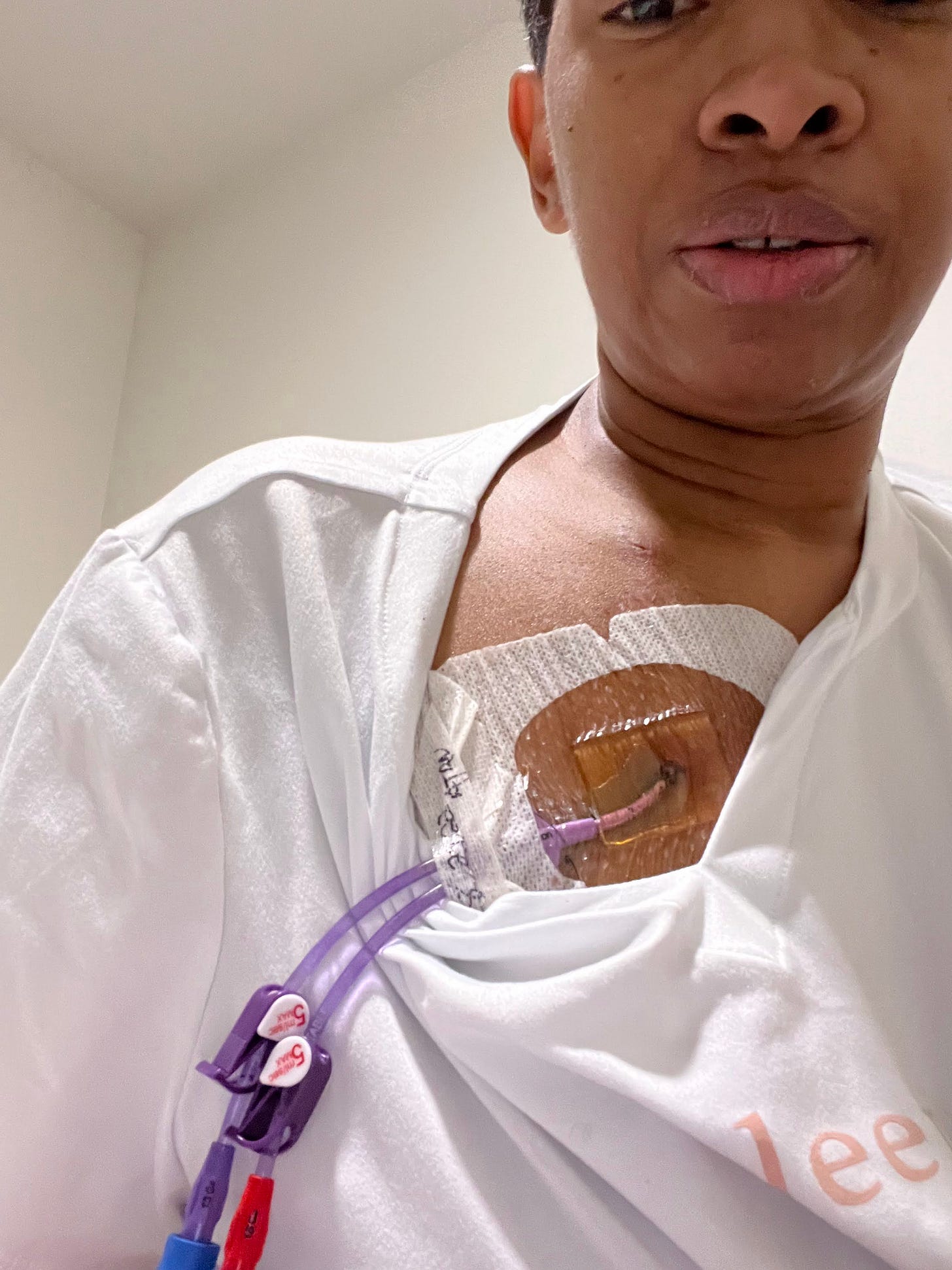 Chemo Was Not the Worst Thing About Cancer (Part 1)