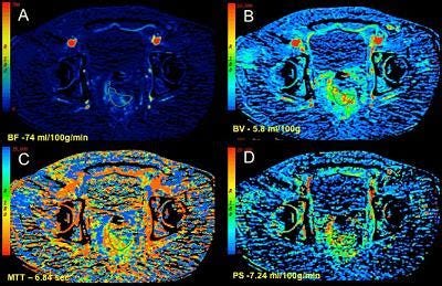CT Scans and Radiation Poisoning | Putting Risk in Context