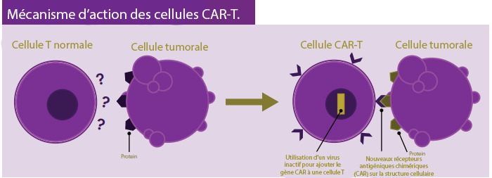 La thérapie CAR T-cell - Lymphoma Canada