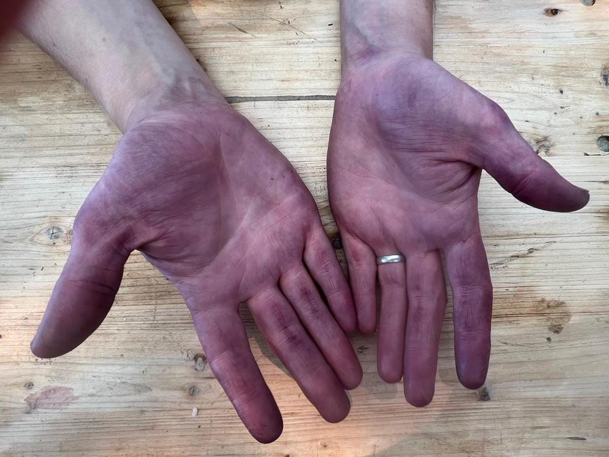 wine stained palms of hands.