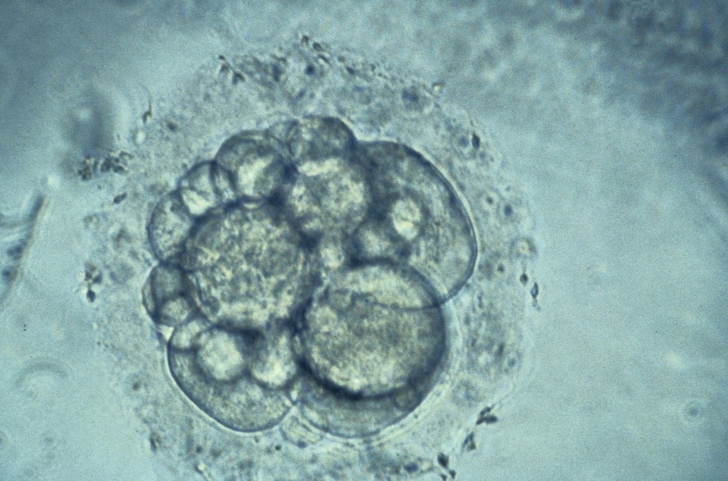 Genetic testing of embryos: An ethical debate unfolds
