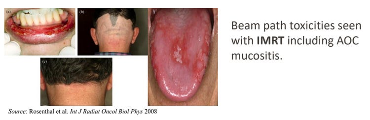 IMRT gives widespread doses of radiation during the course of radiation treatment for head and neck cancer - the pictures show the effect of this radiation on areas not at risk for cancer - this is unwanted radiation to normal tissues.