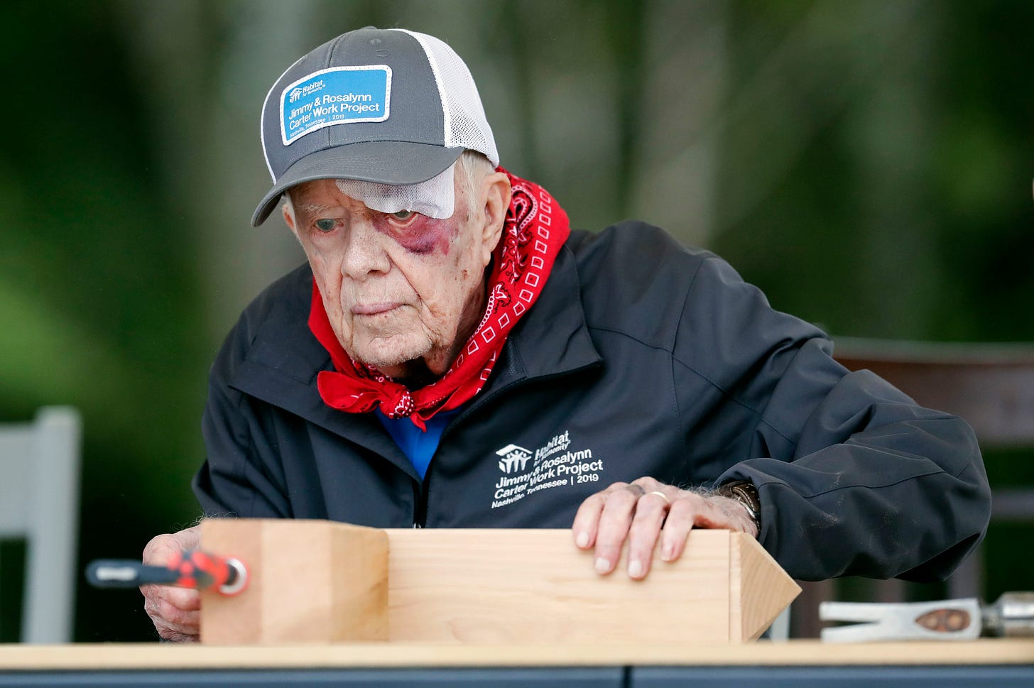 Despite 14 stitches and a black eye, Jimmy Carter is back ...