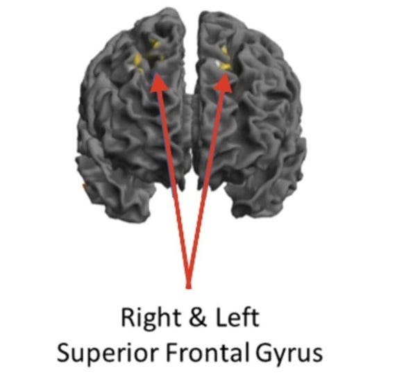 Front-view of the brain. The jazz musicians showed reduced activity in these frontal-lobe areas when in a high-flow state. Image courtesy of Drexel University