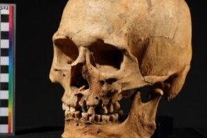 Skull of one of the mysterious backtrackers