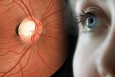 Early Signals of Macular Degeneration You Can't Ignore