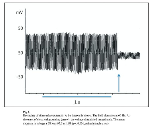 newborn skin surface potential before and after grounding the incubator