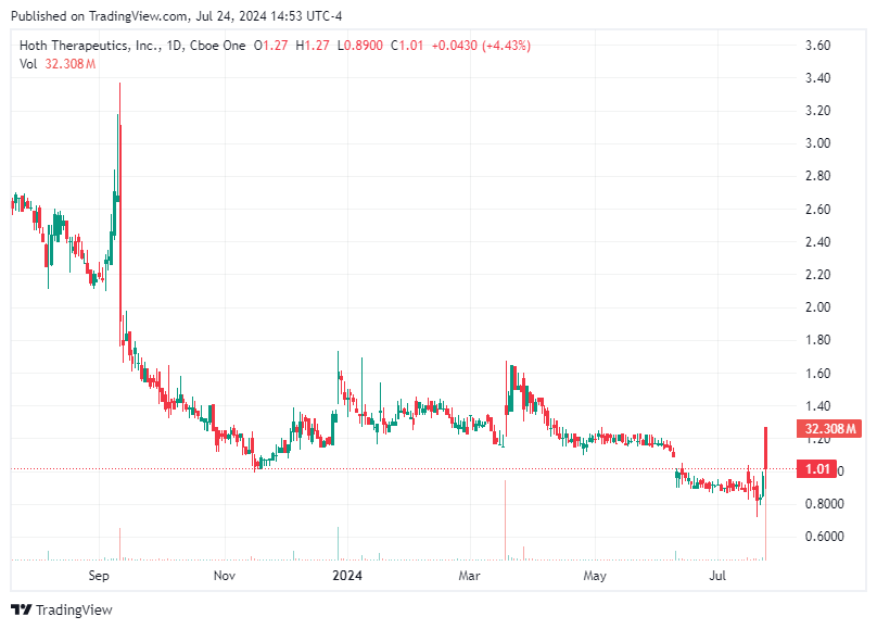 TradingView chart