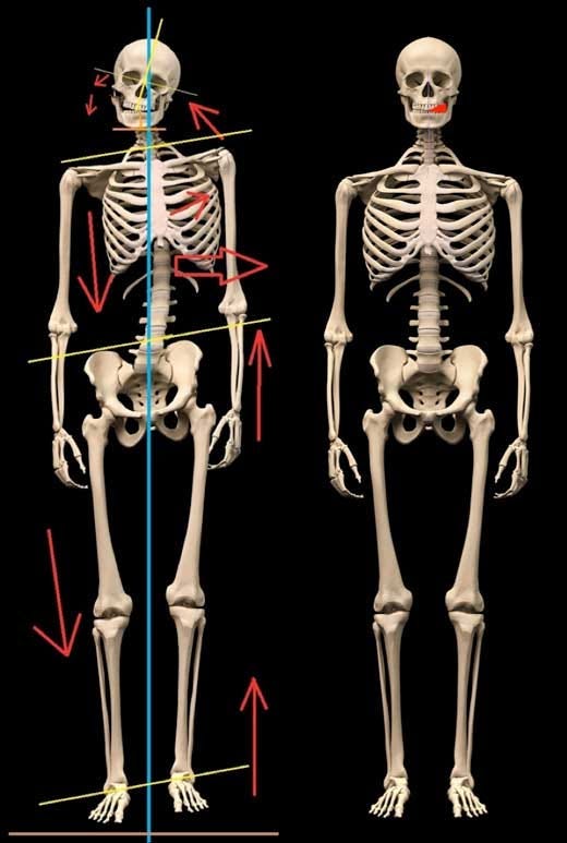 Posture: there are no ascending causes | by Starecta | Medium