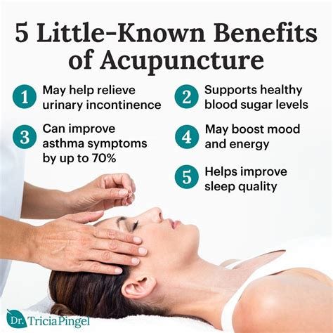 Benefits of Acupuncture | Acupuncture, Health benefits, Health