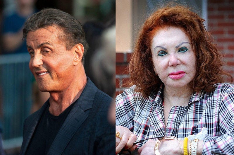 Did Sylvester Stallone Overdo Botox Just like His Mother? - DemotiX