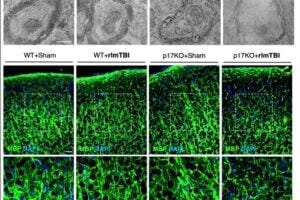 The p17 transporter in mice