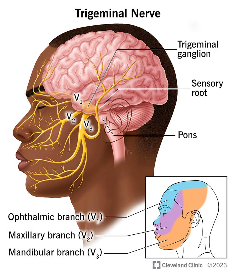 Trigeminal Neuralgia: Symptoms, Causes, Treatment & Surgery