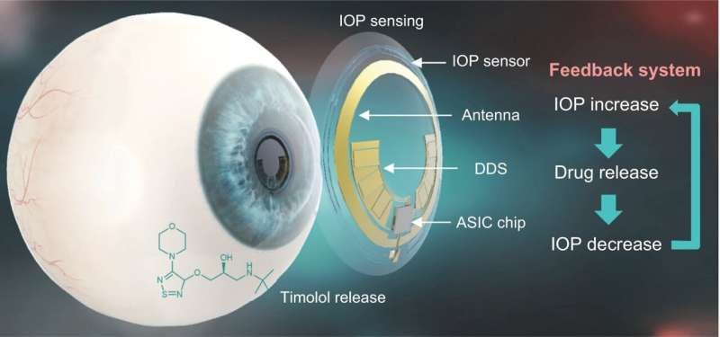 Smart contact lens that diagnoses and treats glaucoma