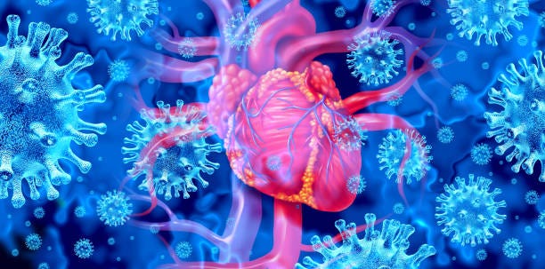 510+ Myocarditis Stock Photos, Pictures & Royalty-Free Images - iStock |  Pericarditis, Myocardium, Woman ekg