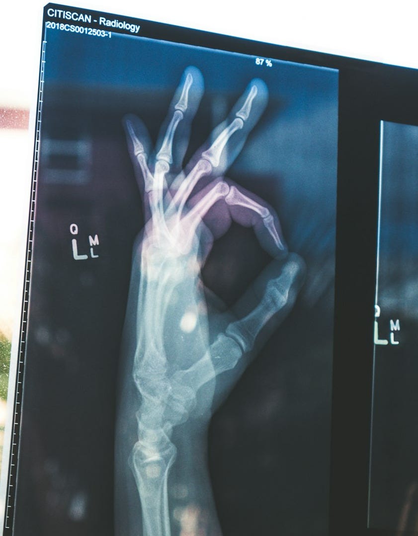citiscan result hand ok citiscan result hand ok