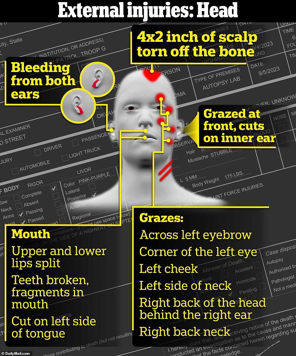 Presgrove suffered external injuries to his face and head that night. The most serious was the chunk of scalp that was torn off his head all the way down to the bone that coincided with the massive internal injuries to his skull and brain that were at their worst at the top and back of the head. The piece of scalp and hair was found on the highway feet away. Many of Presgrove's teeth were also broken and some were knocked out and found on the road