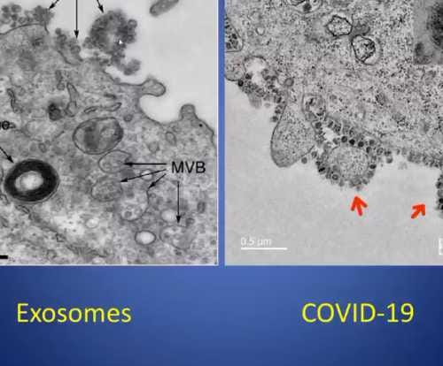 microscope showing pictures of exosomes and COVID-19