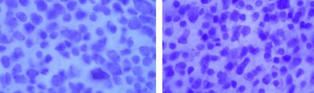 These high magnification digital photos show the high density of photoreceptor cells in the central region of the retina in left, the eye of a turkey vulture, and right, the eye of a black vulture. The high density of receptor cells in this region indicates both birds have keen eyesight.