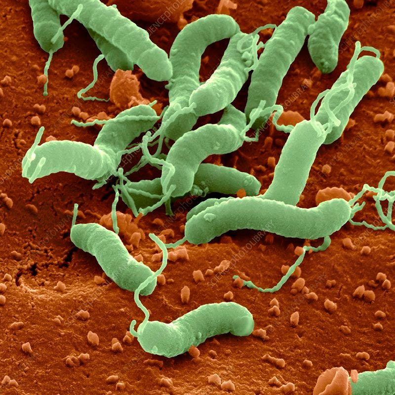 Helicobacter pylori bacteria, SEM