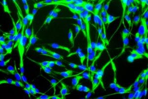 Neural stem cells, shown here, can be made to develop into the varied types of cells found in the nervous system.