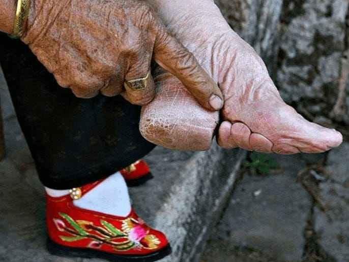 Thanks, I hate Ancient China foot binding. : r/TIHI