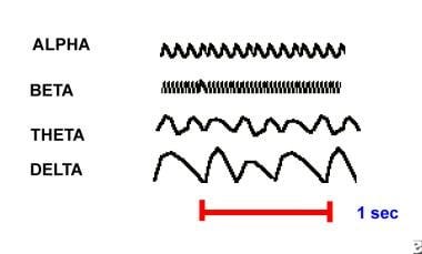 Normal EEG Waveforms