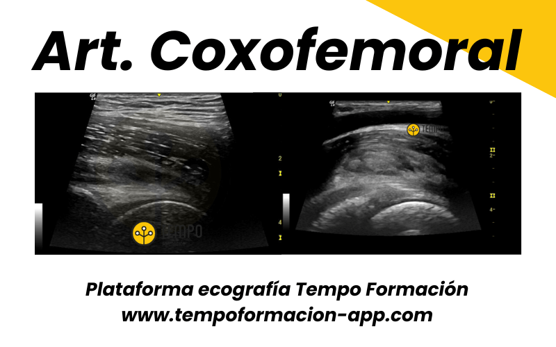 5.  Ecografia Tempo Formacion Articulacion Coxofemoral.png