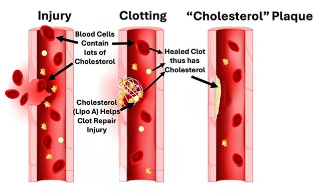 blood cholesterol