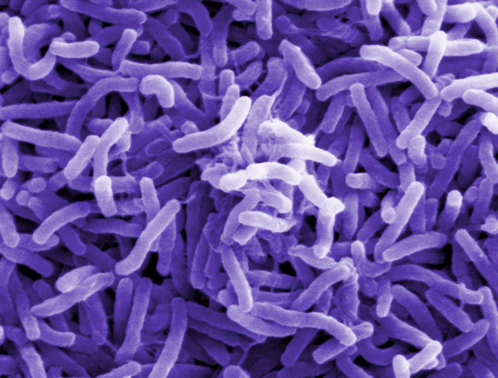 Cholera bacteria (Vibrio cholerae) | Scanning electron micro… | Flickr