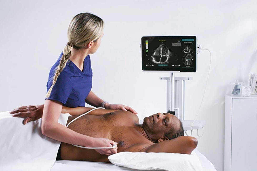 AI-guided ultrasound image acquisition software, Caption Health