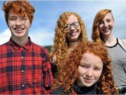 Dr. Peter Nieman: Red-haired people face unique health issues | Calgary  Herald