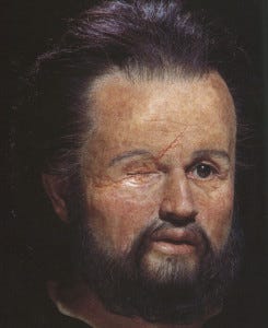 Philip II with his scar