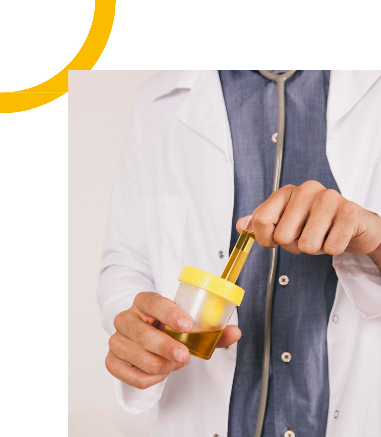 Bladder cancer awareness - by Ashwin Sridhar