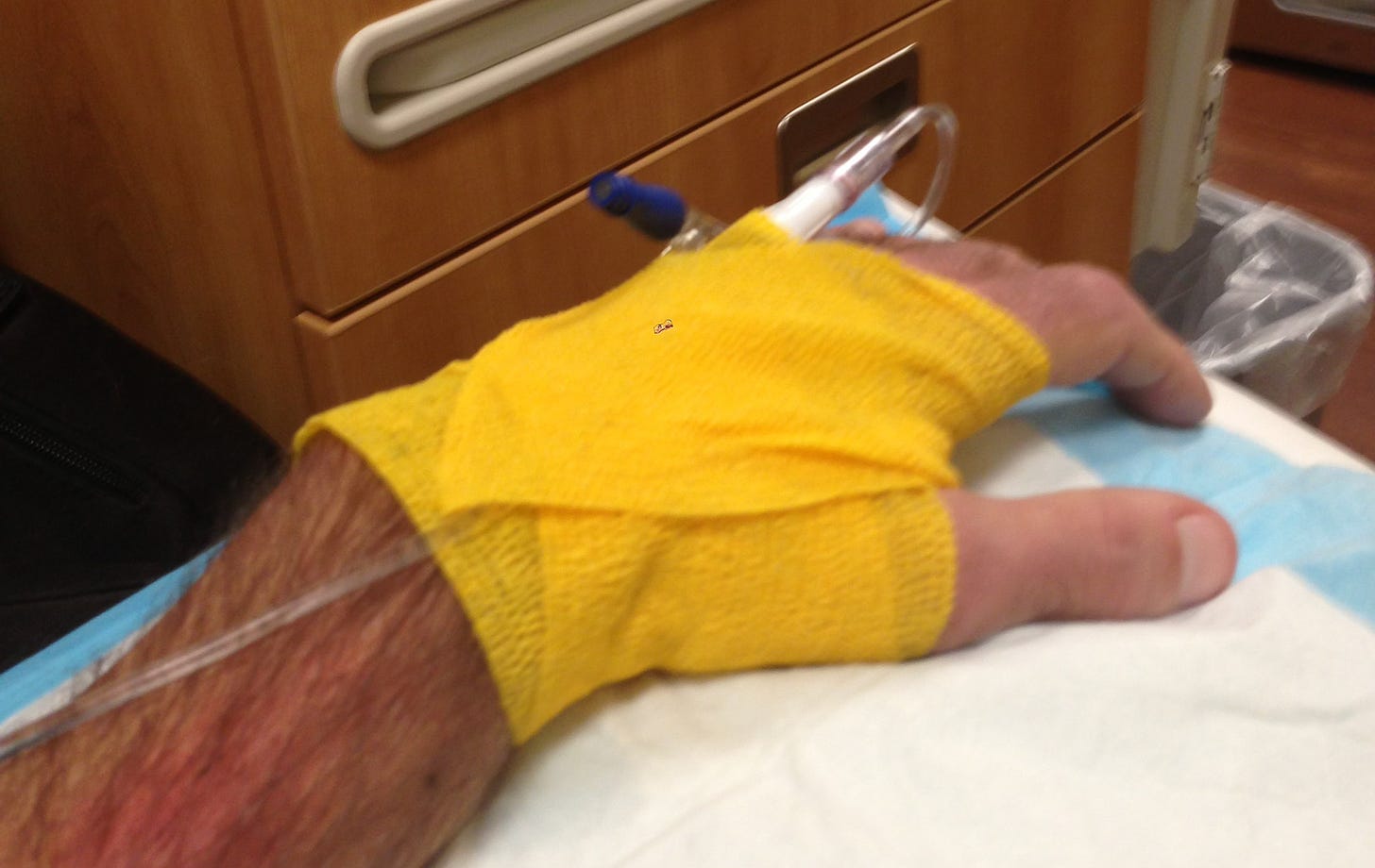 A bandaged hand with an IV attached being administered IVIG. The bandage is yellow.