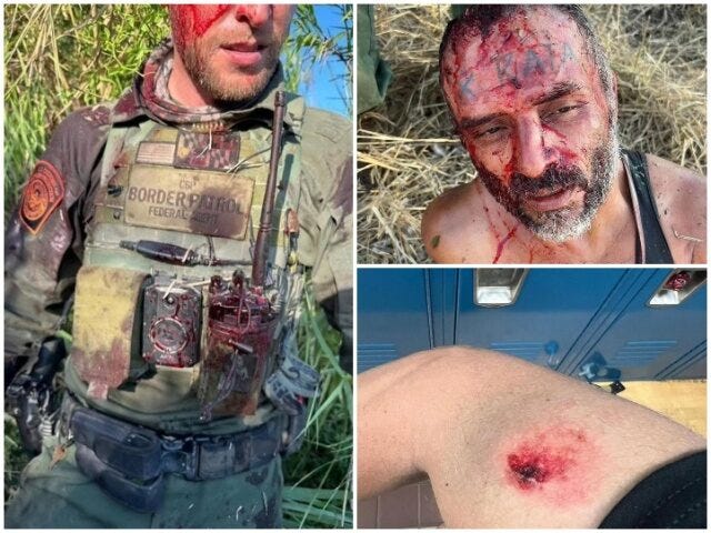 Border Patrol Agent Assaulted in New Mexico (File Photos: U.S. Border Patrol)