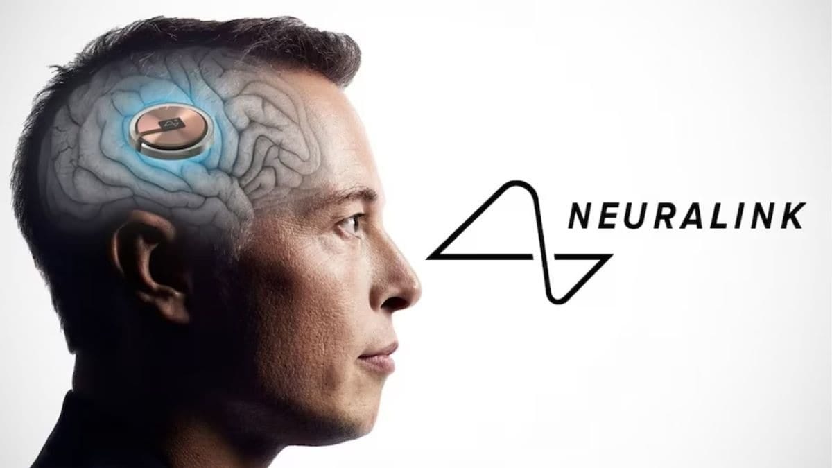 Thousands in line to get brain chip implant by Elon Musk's Neuralink -  BusinessToday