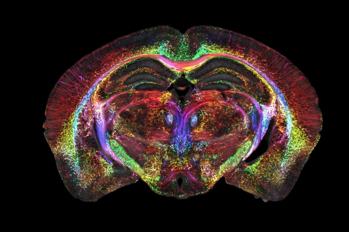 MRI and light sheet microscopy has offered a new look inside an entire mouse brain