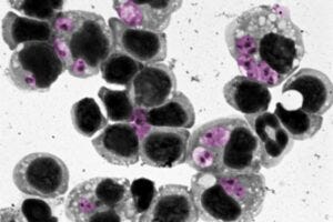 A closeup of leishmaniasis