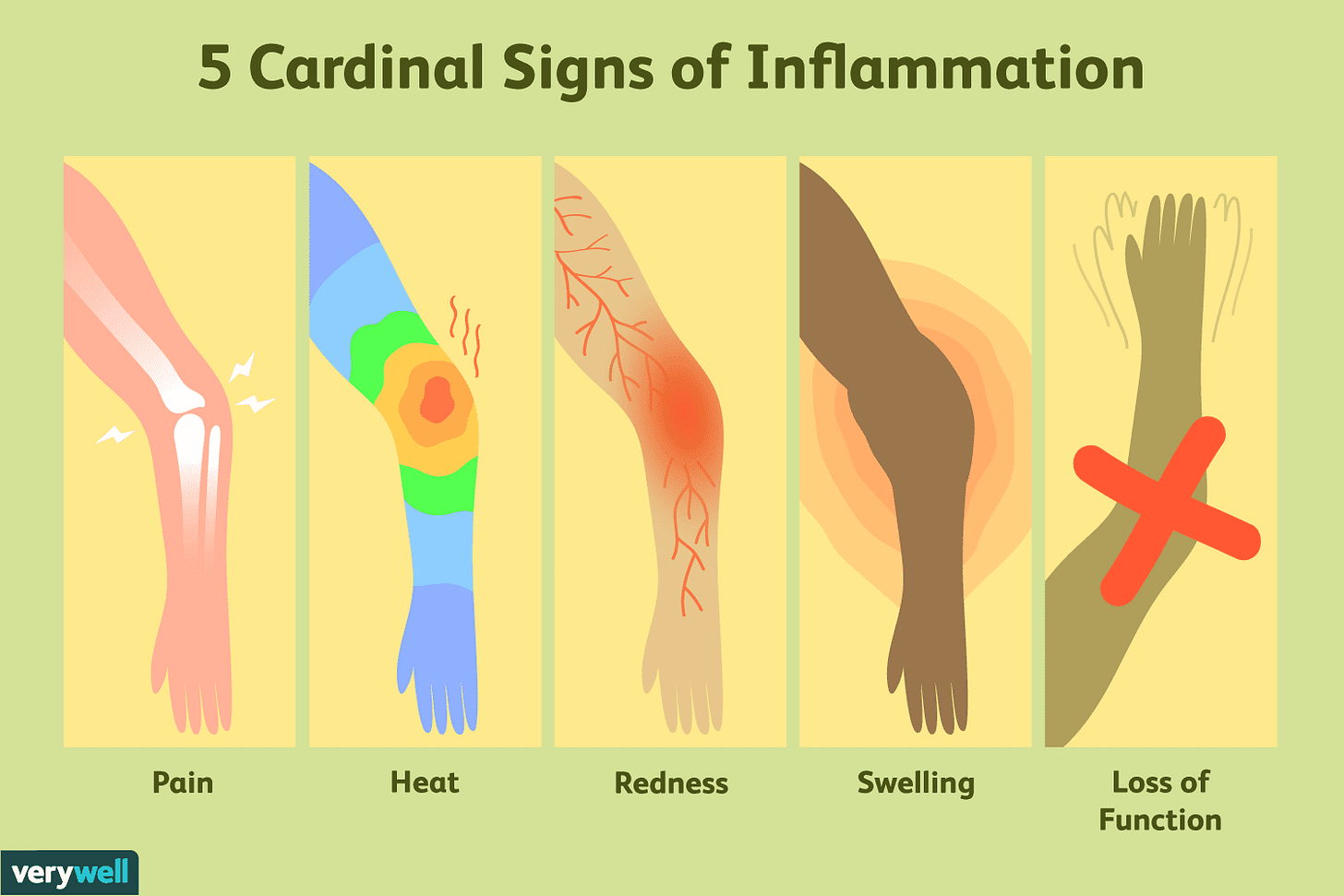 Signs of Inflammation and How to Flush It Out