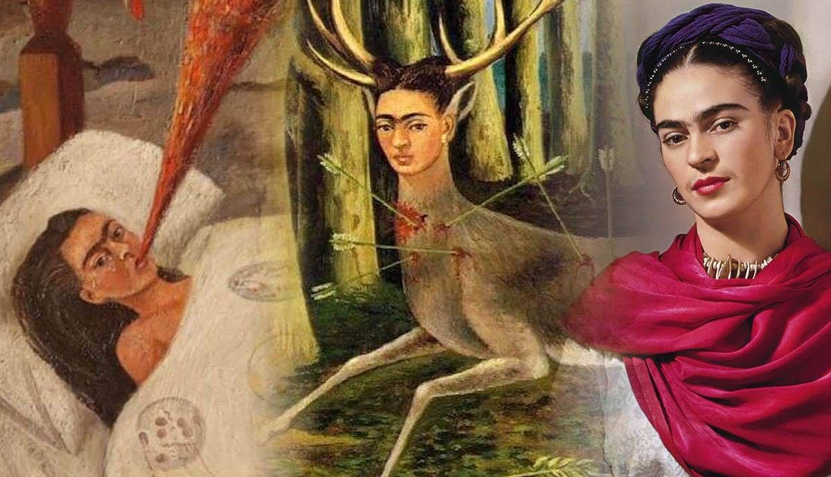 frida kahlo chronic pain