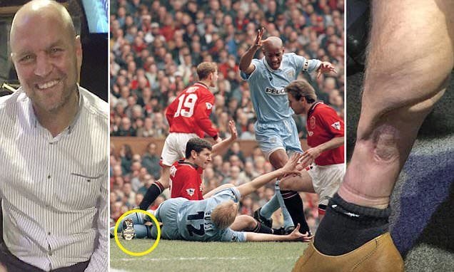 david busst leg injury