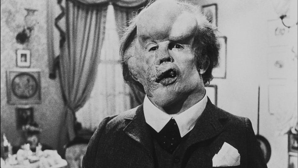 Film - The Elephant Man - Into Film