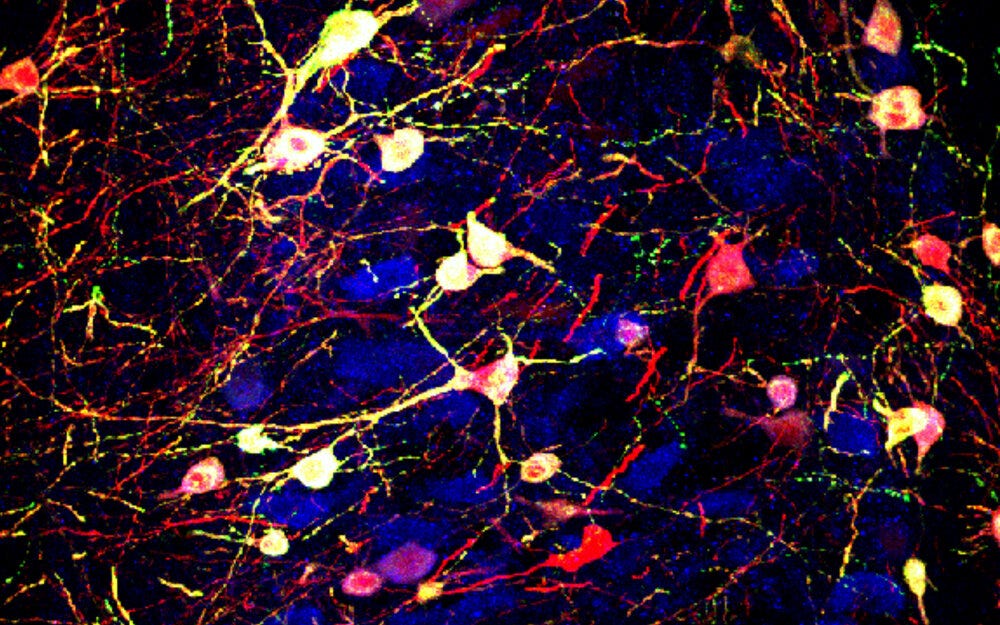 A group of midbrain neurons expressing acetylcholine (blue) are made to express another type of neurotransmitter, glutamate (yellow). photo: UCSD