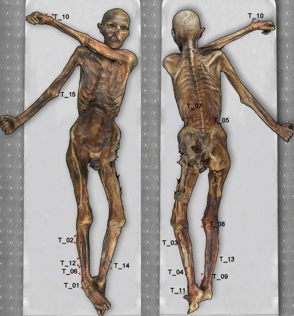 Ötzi. primer hombre con tatuajes