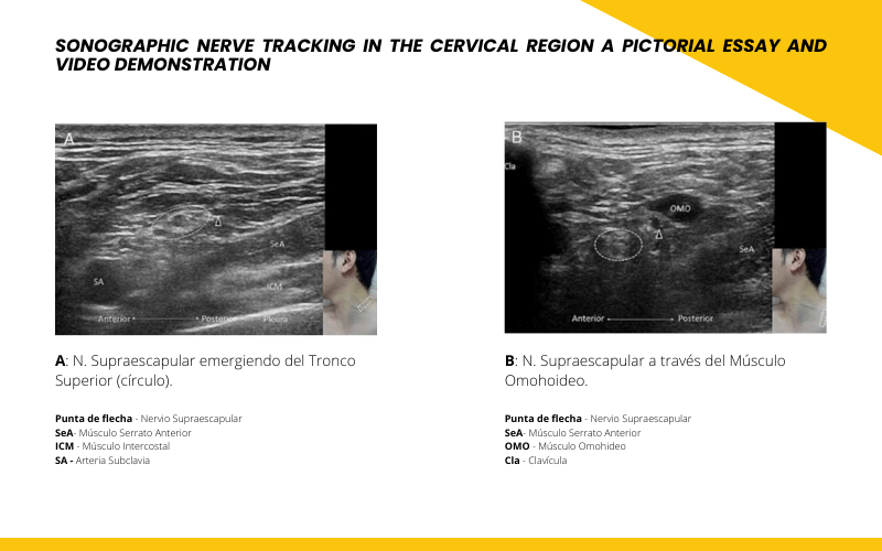 Nervio supraescapular ecografia tempo formacion.png
