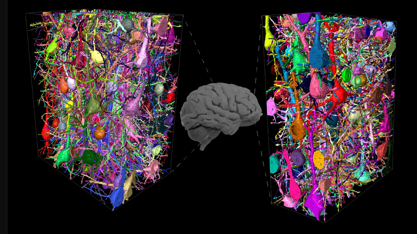 What Makes the Human Brain More Complex? | Technology Networks