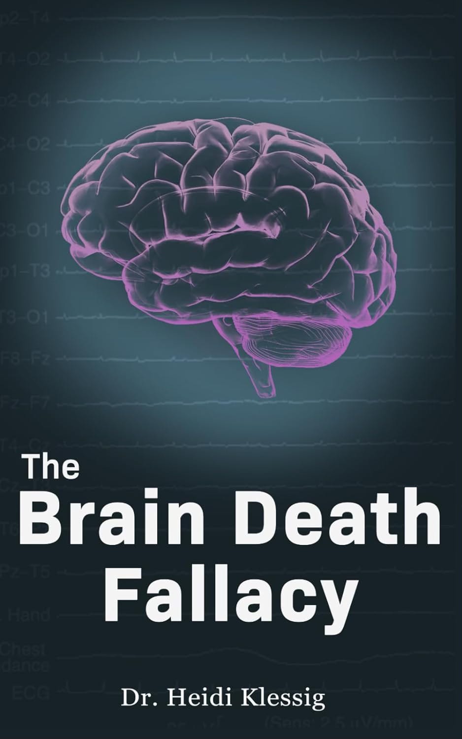 The Brain Death Fallacy