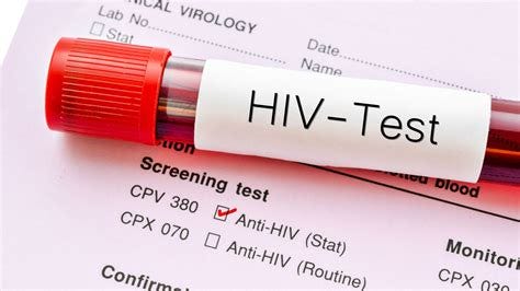 Treatment stops HIV transmission, study finds | UK News | Sky News