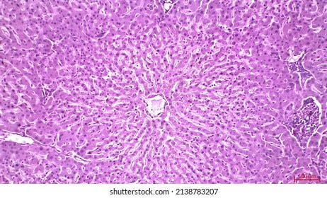 2,039 Liver Histology Images, Stock Photos, 3D objects, & Vectors |  Shutterstock